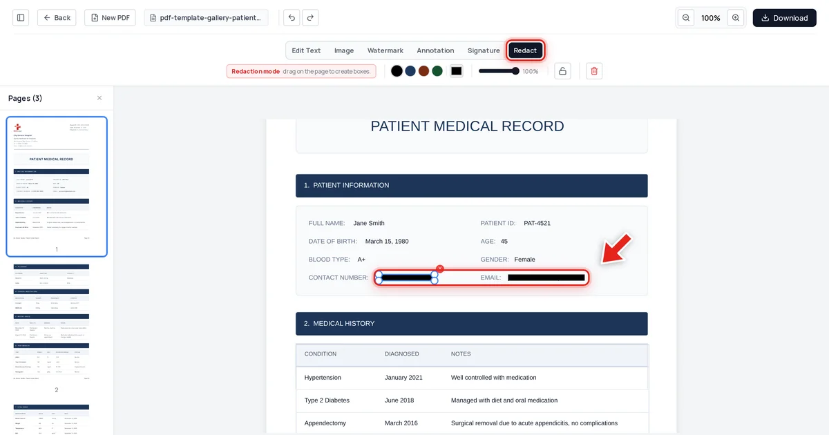 A patient's email address redacted with a black bar in a medical record PDF, shown in Redaction mode