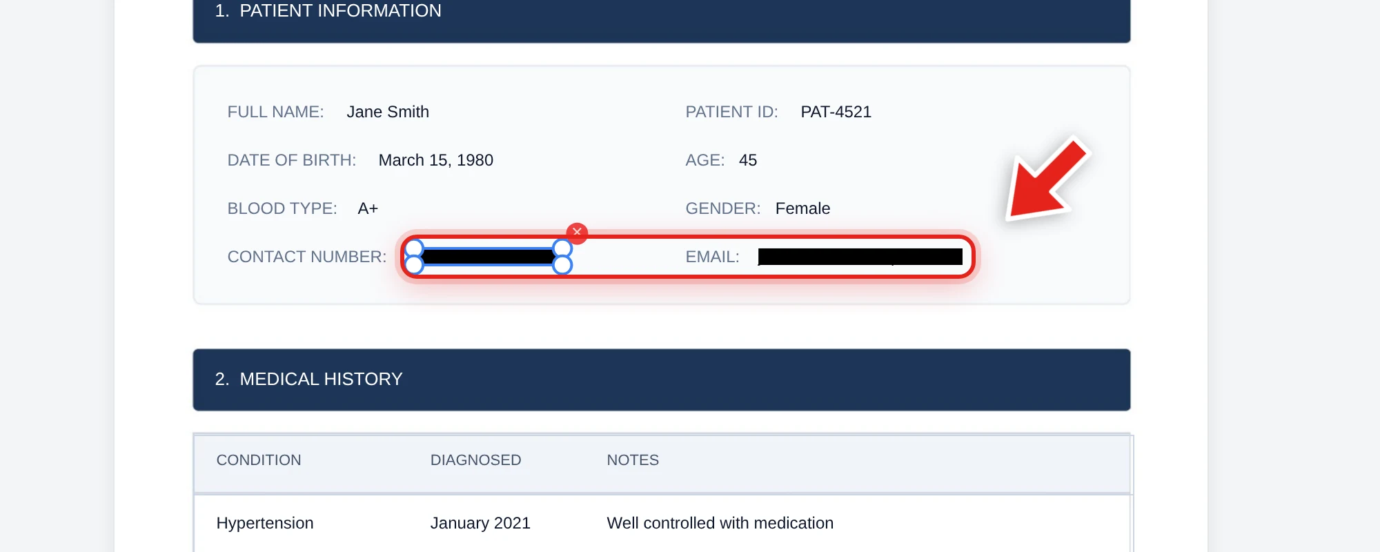 A patient's contact number and email redacted with black bars in a medical record, shown in Redaction mode
