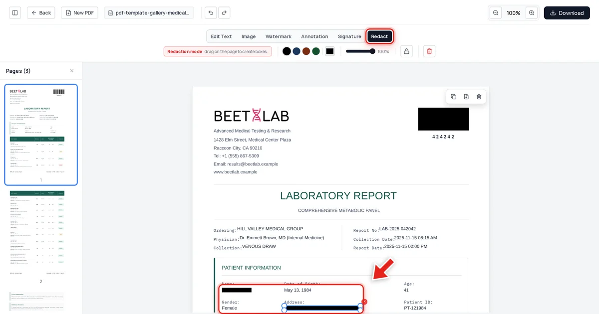 A patient's name redacted with a black bar in a lab test report, shown in Redaction mode