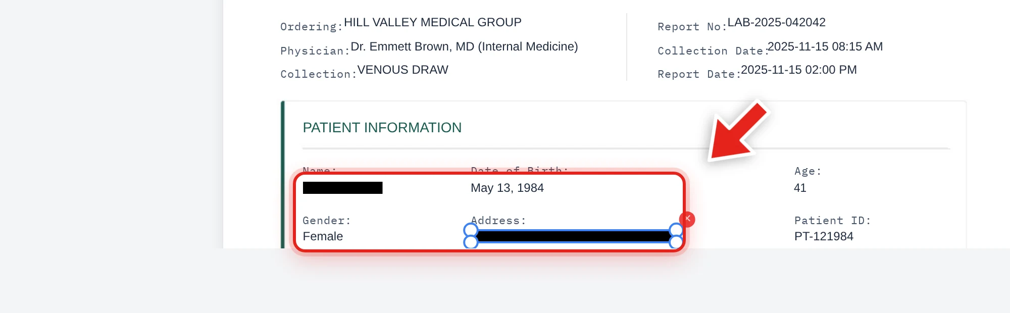 A patient's name and address redacted with black bars in a lab test report, shown in Redaction mode